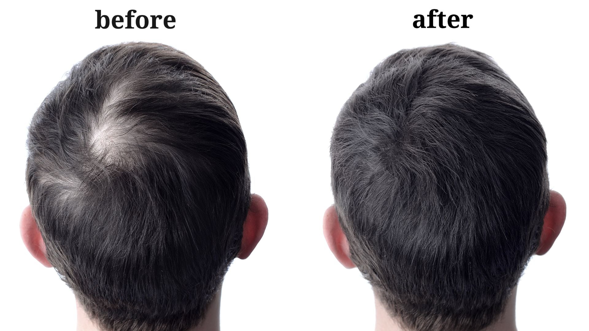 Step-by-Step Tutorial: How to Apply Hair Building Fiber for Natural-Looking Results