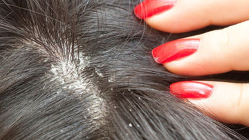 hair serum for dandruff relief