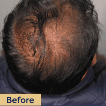 Adomour Hair Building Fiber