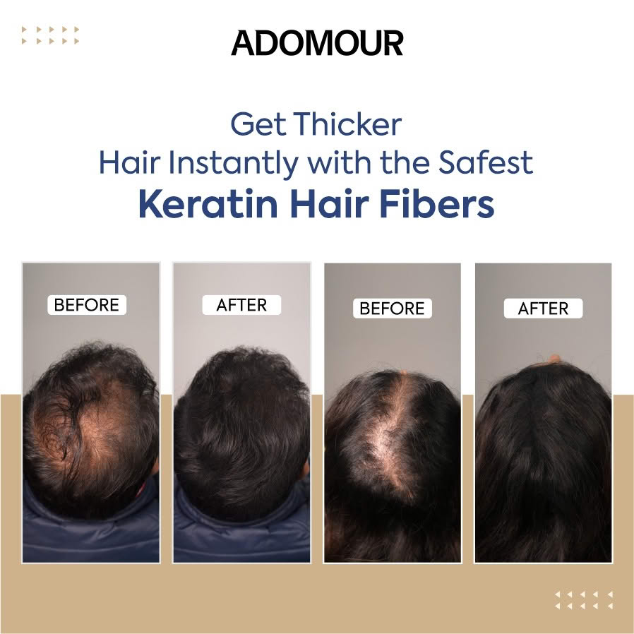 Best hair fiber for thinning hair showing multiple before after comparisons using hair building fiber and bald concealer